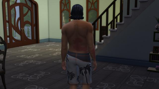 Burn Scars for The Sims 4